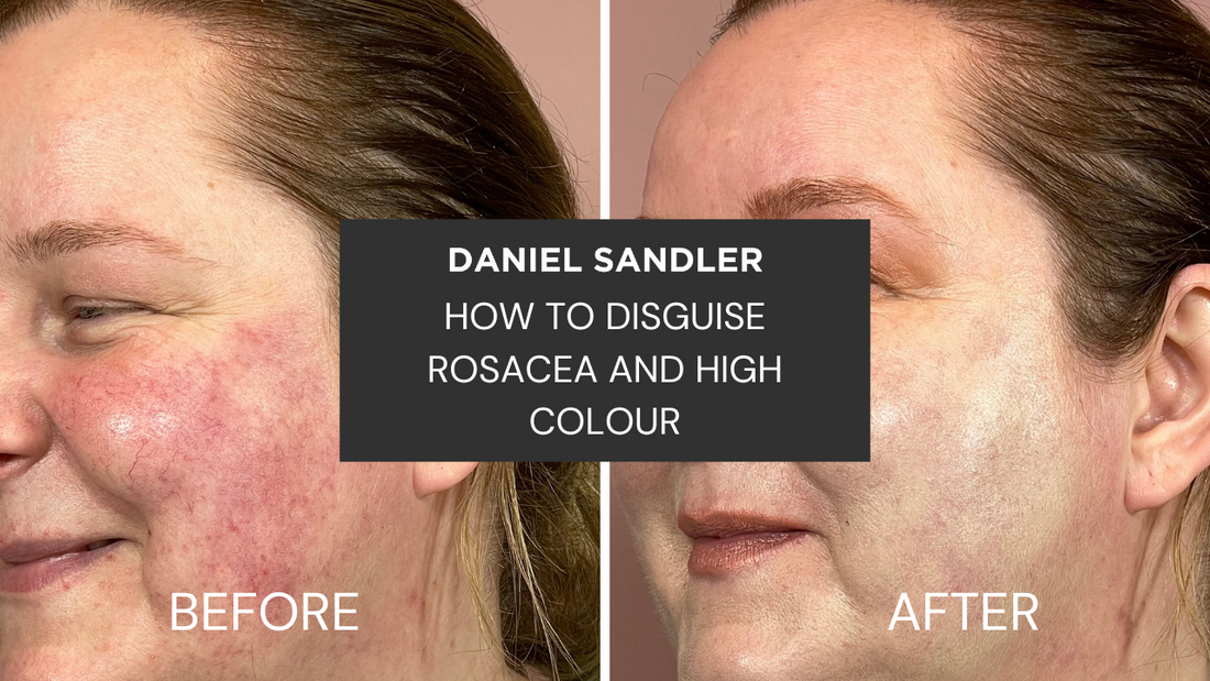 HOW TO DISGUISE ROSACEA AND HIGH COLOUR